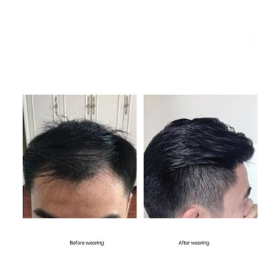 Full Hand Made Slicked Back Style Hairline 100% Reposição de Cabelo Humano Toupee para Homens